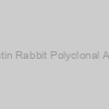 beta Actin Rabbit Polyclonal Antibody